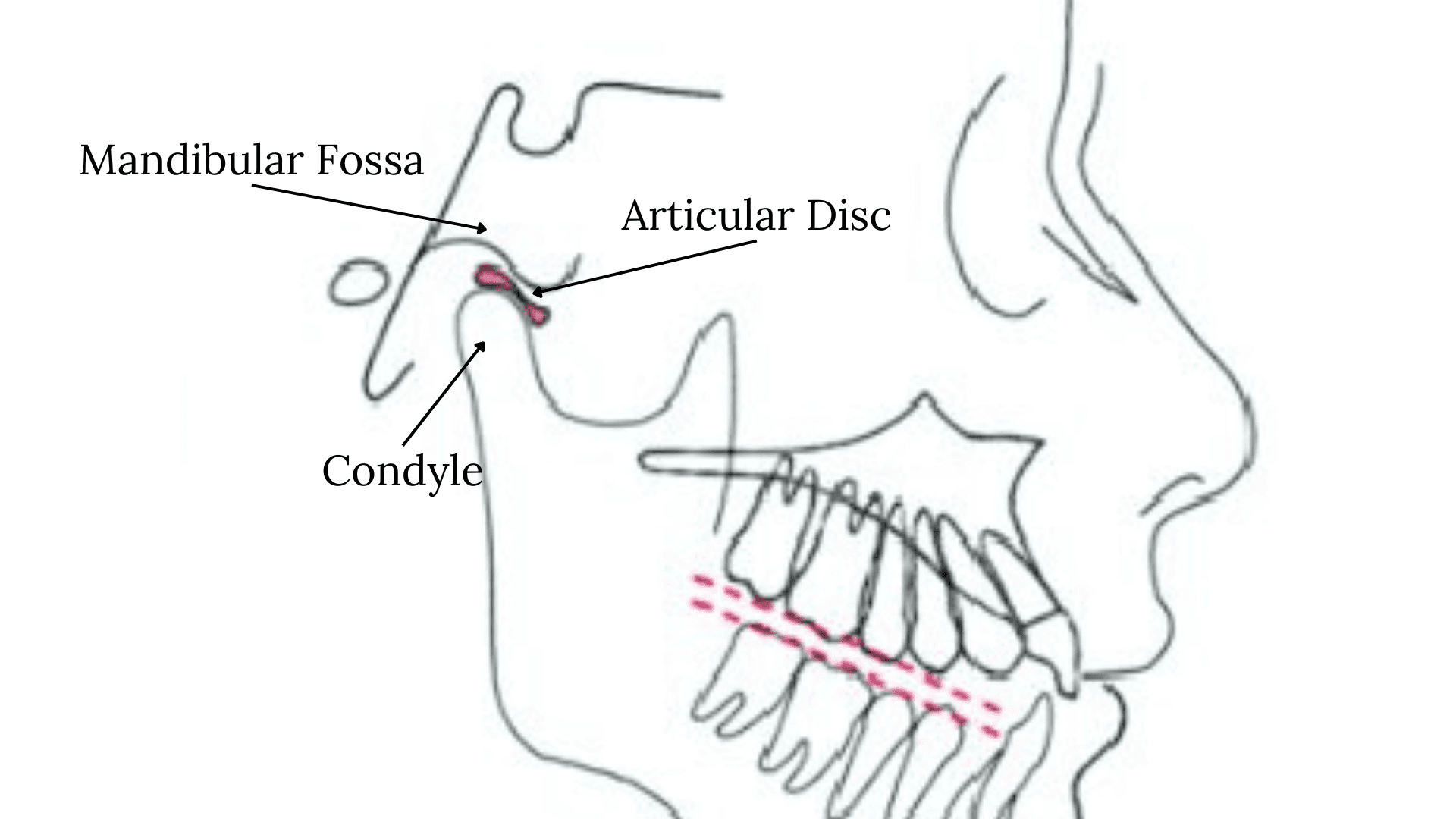 Diagram of TMJ Joint